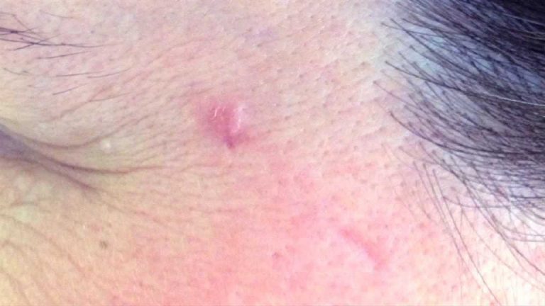 L’Actu – Se protéger du soleil, même en ce moment