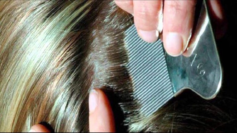 Traiter les poux, les conseils d’une infirmière scolaire