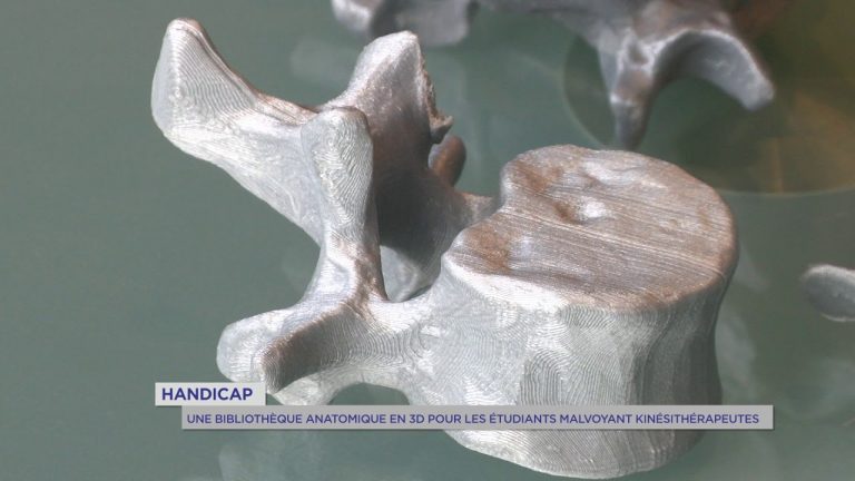 Handicap : une bibliothèque anatomique en 3D pour les étudiants malvoyants kinésithérapeutes